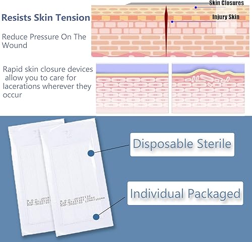 Miniatura 3 de Mediss Vendajes adhesivos desechables para heridas en la piel, tiras de puntada estéril después de lesiones, supervivencia, curación, 10 unidades