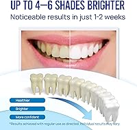 Vista 2 de Kit de Lápiz Blanqueador de Dientes en Gel: Gel de Peróxido de Carbamida al 35% para la Eliminación de Manchas - Sin Sensibilidad con Lápiz