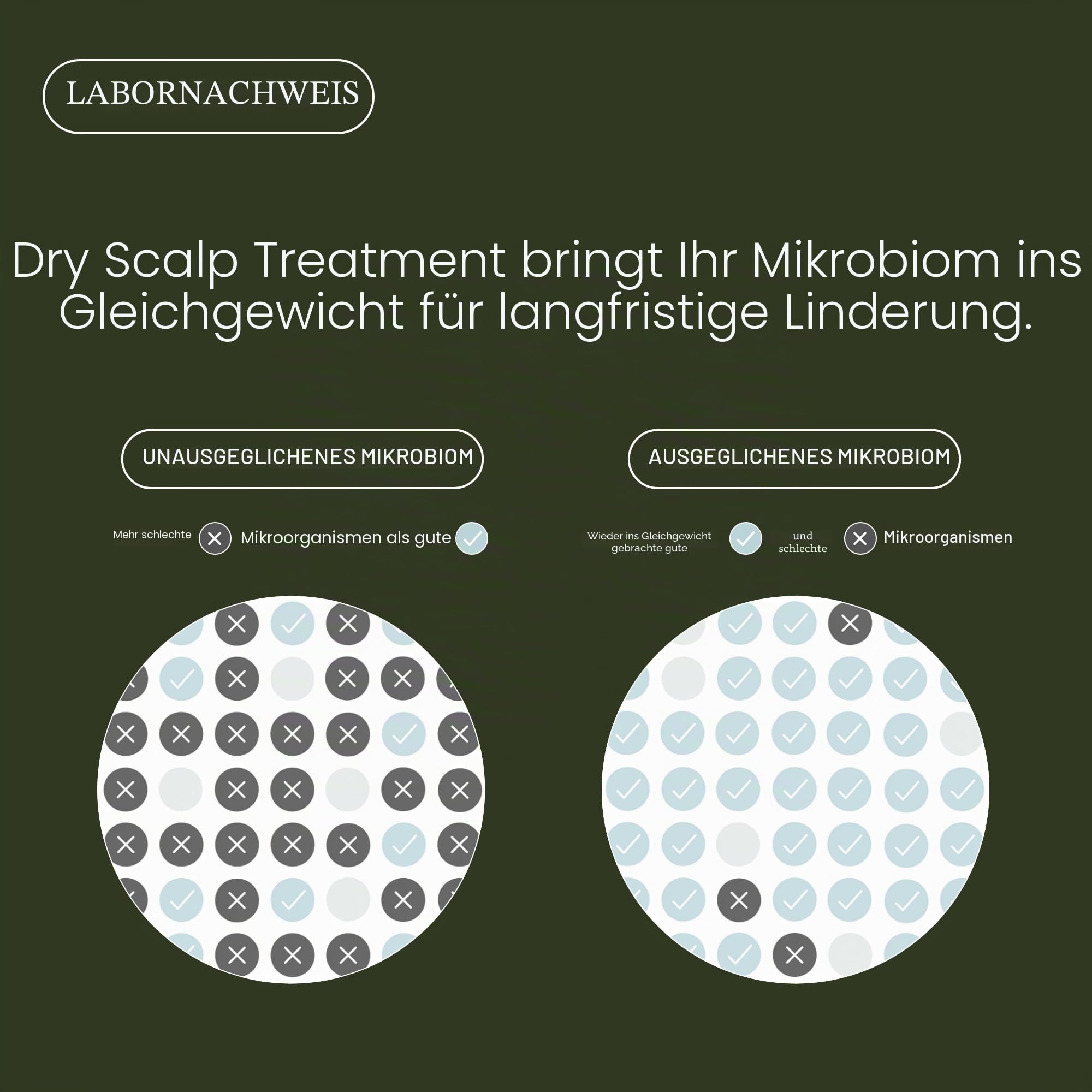 Living Proof Scalp Care Dry Scalp Treatment | Feuchtigkeitsspendendes Kopfhaut-Konzentrat für trockene Kopfhaut | Beruhigt, lindert Schuppen & Juckreiz | Vegan, ohne Parabene, Silikone, Sulfate |100ml