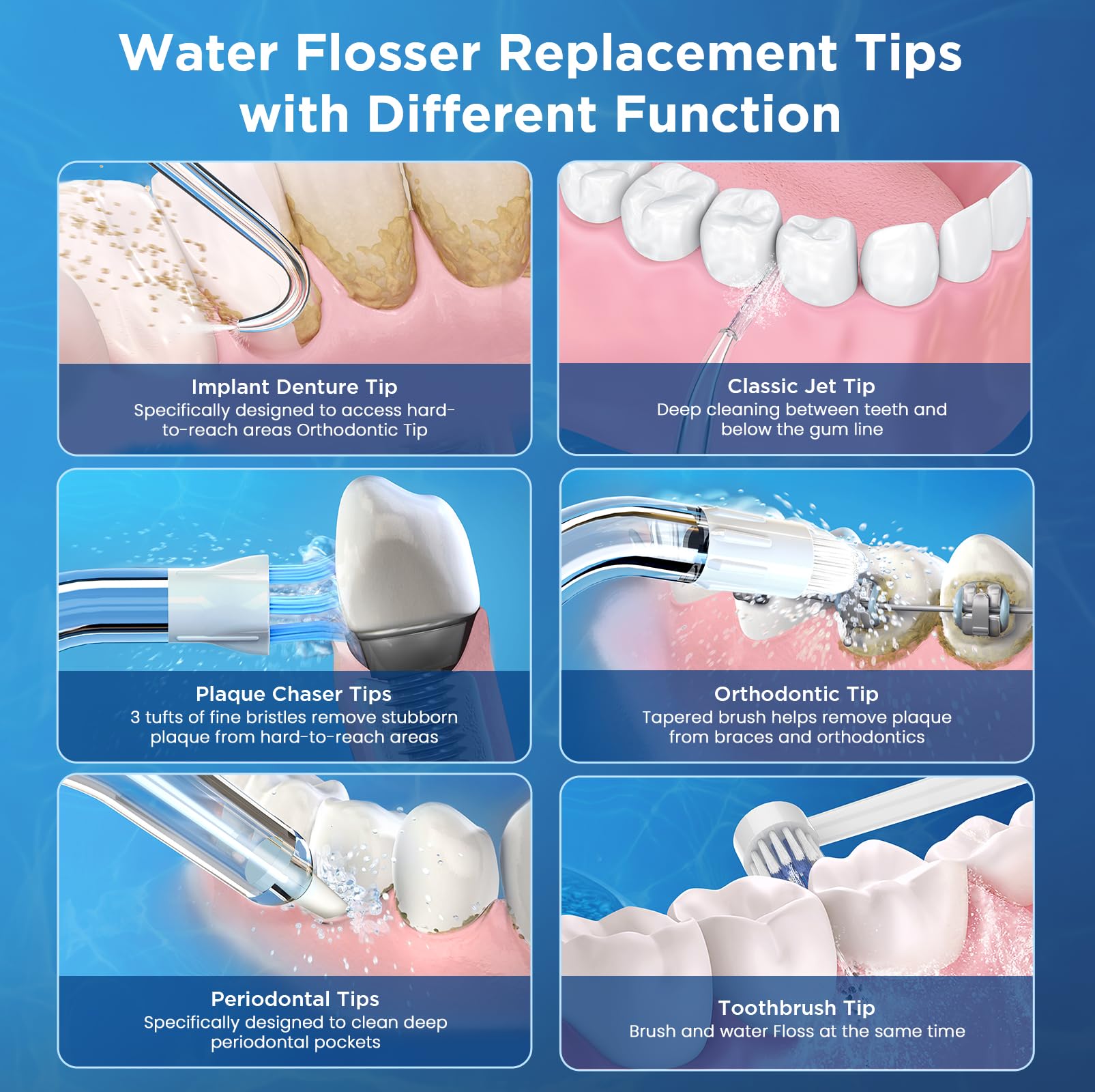 Para cabezales de repuesto Waterpik, 12 púas de repuesto para hilo dental de agua (6 puntas clásicas de chorro + otras 6 puntas diferentes)