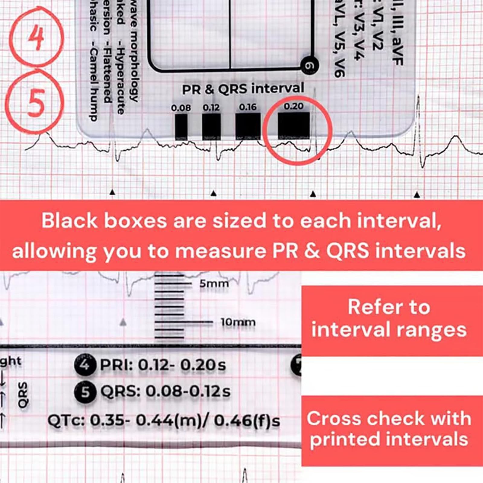 Tarjeta de regla de electrocardiograma de 7 pasos para una interpretación precisa y un análisis rápido en la herramienta de evaluación de configuración médica, herramienta de diagnóstico