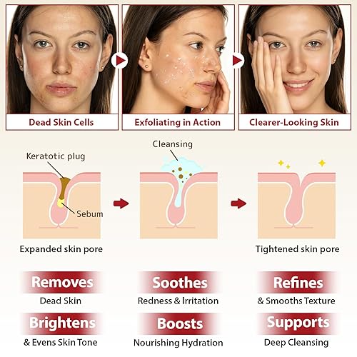 Miniatura 8 de Ampolla exfoliante de arroz negro y arroz blanco peeling Glow 3.4 fl oz, 2 piezas de suero facial de arroz blanco y negro, exfoliante suave para