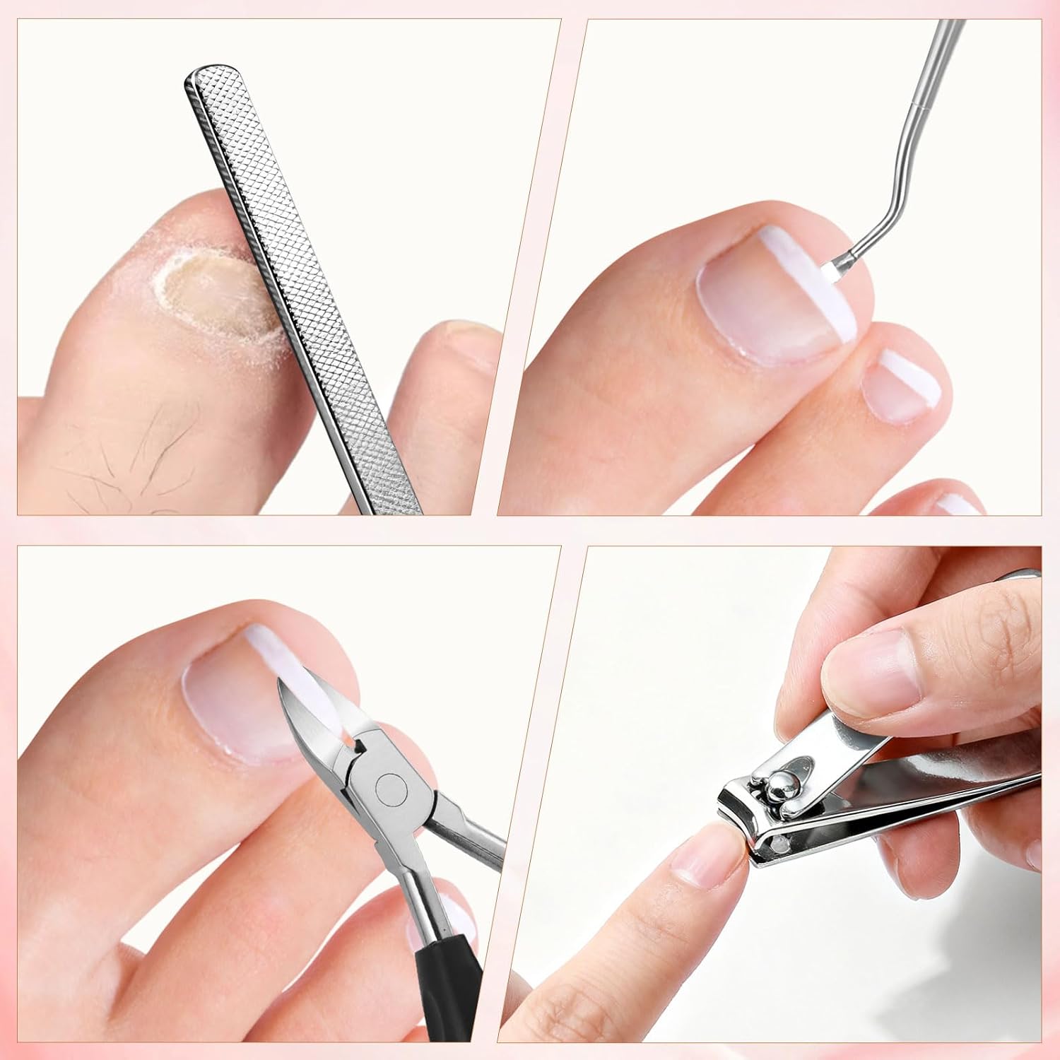 Professional Ingrown Toenail Correction Kit, 18-in-1 Pedicure Tool Set with Clippers, Nail Corrector, Correction Patches, Pedicure Tools and Storage Box, Home Foot Care Kit for Toenail Treatment