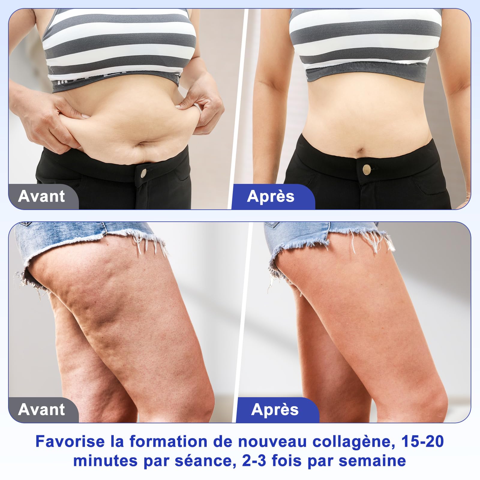 Appareil de massage 40K 4-en-1, lipocavitation et radiofréquence, appareil de soins adapté au visage et au corps