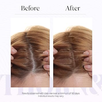 Hair Growth Serum for Thinning Hair | Thicker Fuller Hair Thickening Serum | Rosemary Oil, Saw Palmetto, Biotin Multi Peptides, Redensyl | Topical Caffeine Scalp Serum for Women | Density DHT Blocker