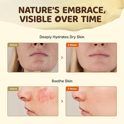 Miniatura 5 de Vigority Sargo de res y bálsamo de miel Sopa de res batida orgánica alimentada con pasto para la piel - Hidratante facial de ternera con infusión de