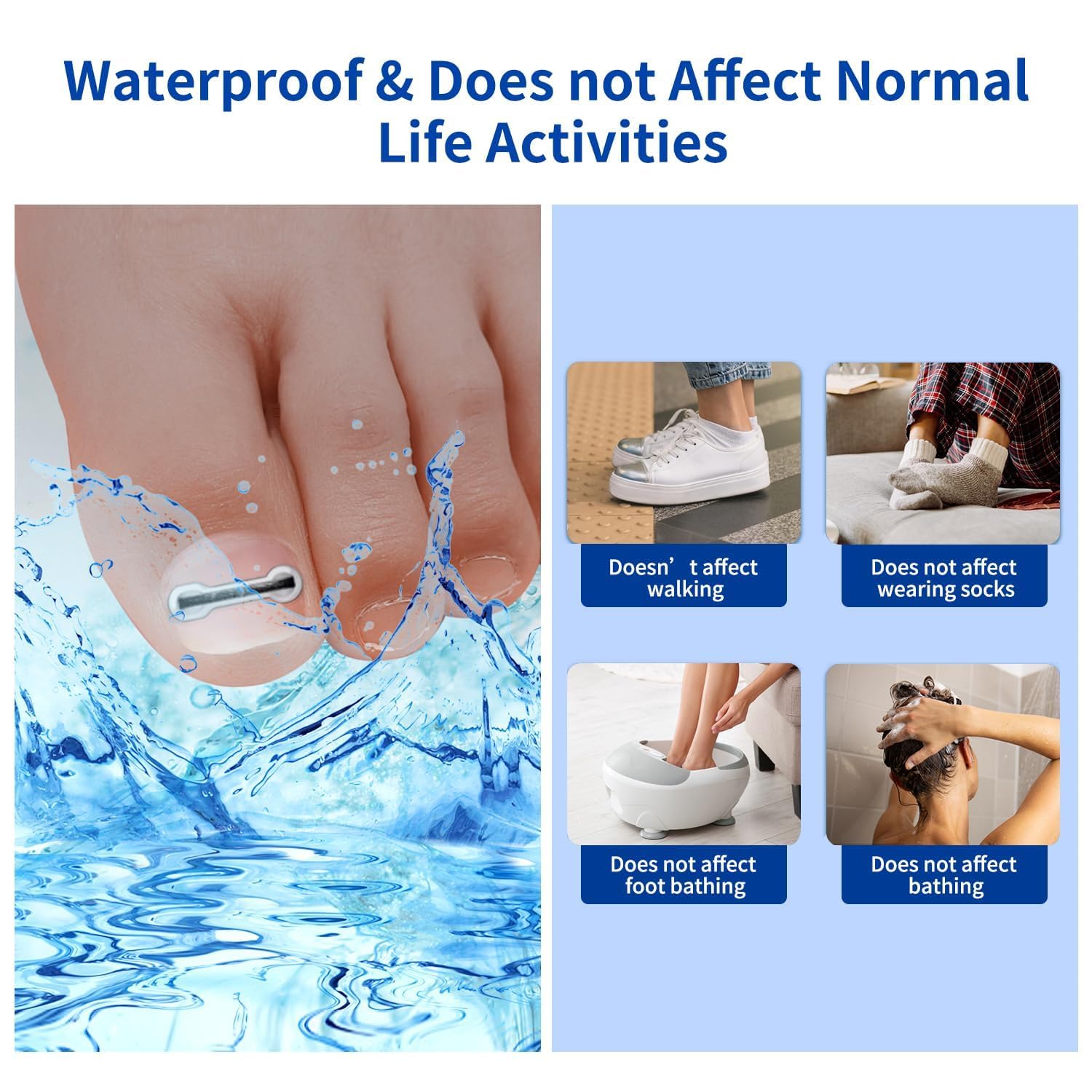 Ingrown Toenail Treatment, 10 packs Titanium Alloy Ingrown Toenail Corrector for all size foot, Ingrown Toenail Removal Kit for Curved Nail Repair, at Home Nail Kit Tools-Blue-v1