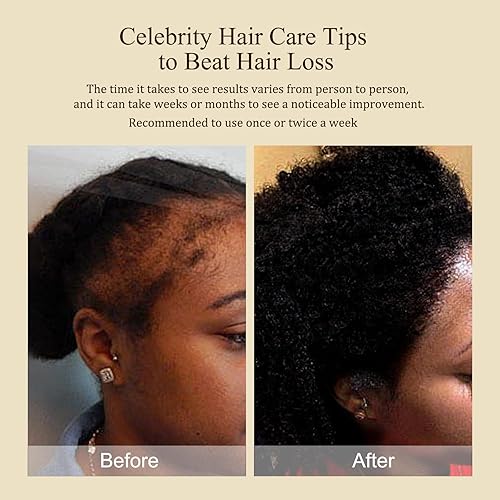 Miniatura 4 de Civavo Aceite de batana orgánico para cabello, 100% puro natural prensado nutritivo aceite de batana mascarilla para el cabello contra la pérdida de