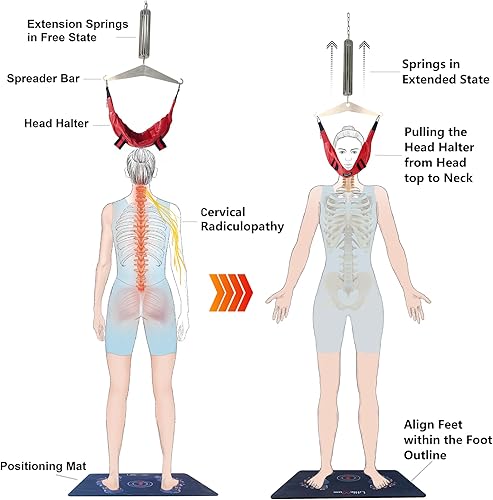 Miniatura 4 de LittleMum Aparato de tracción cervical, descompresión espinal, camilla de cuello para radiculopatía cervical, nervio pellizcado cuello, jorobado,