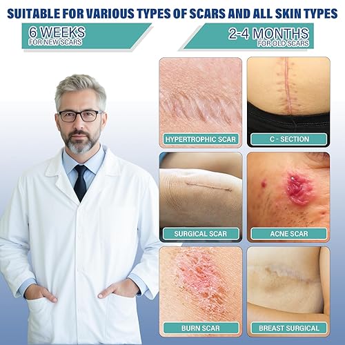 Miniatura 2 de Silicone Scar Sheets,Silicone Scar Tape(1.6"x 158" Roll-4 meters),Silicone Scar Sheets for Surgical Scars,Keloid Bump Removal,Scar Tape for