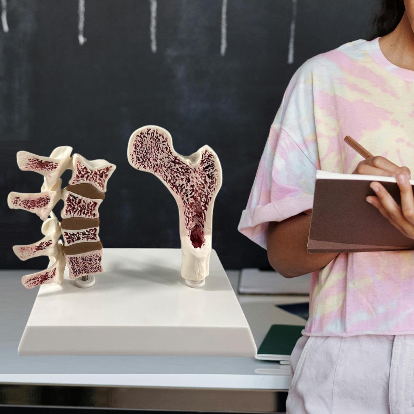Modelo Portátil de Fémur Humano con Osteoporosis, Esqueleto Educativo con Vértebras, Kit de Aprendizaje de Material de PVC, Adecuado para La