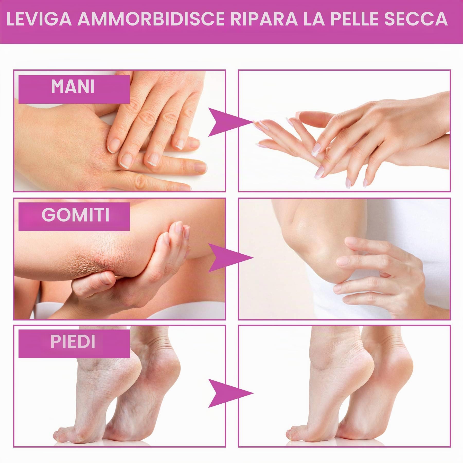 Dispositivo per Bagno di Paraffina per mani e Piedi, con Accessori, Vasca per Cera Elettrica, con Cera di Paraffina 265W