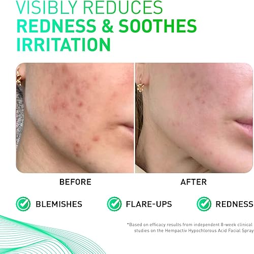 Miniatura 3 de HEMPACTIV Aerosol de ácido hipocloroso para rostro y piel  Limpiador facial suave HOCL post-entrenamiento para todo tipo de piel  Aerosol facial