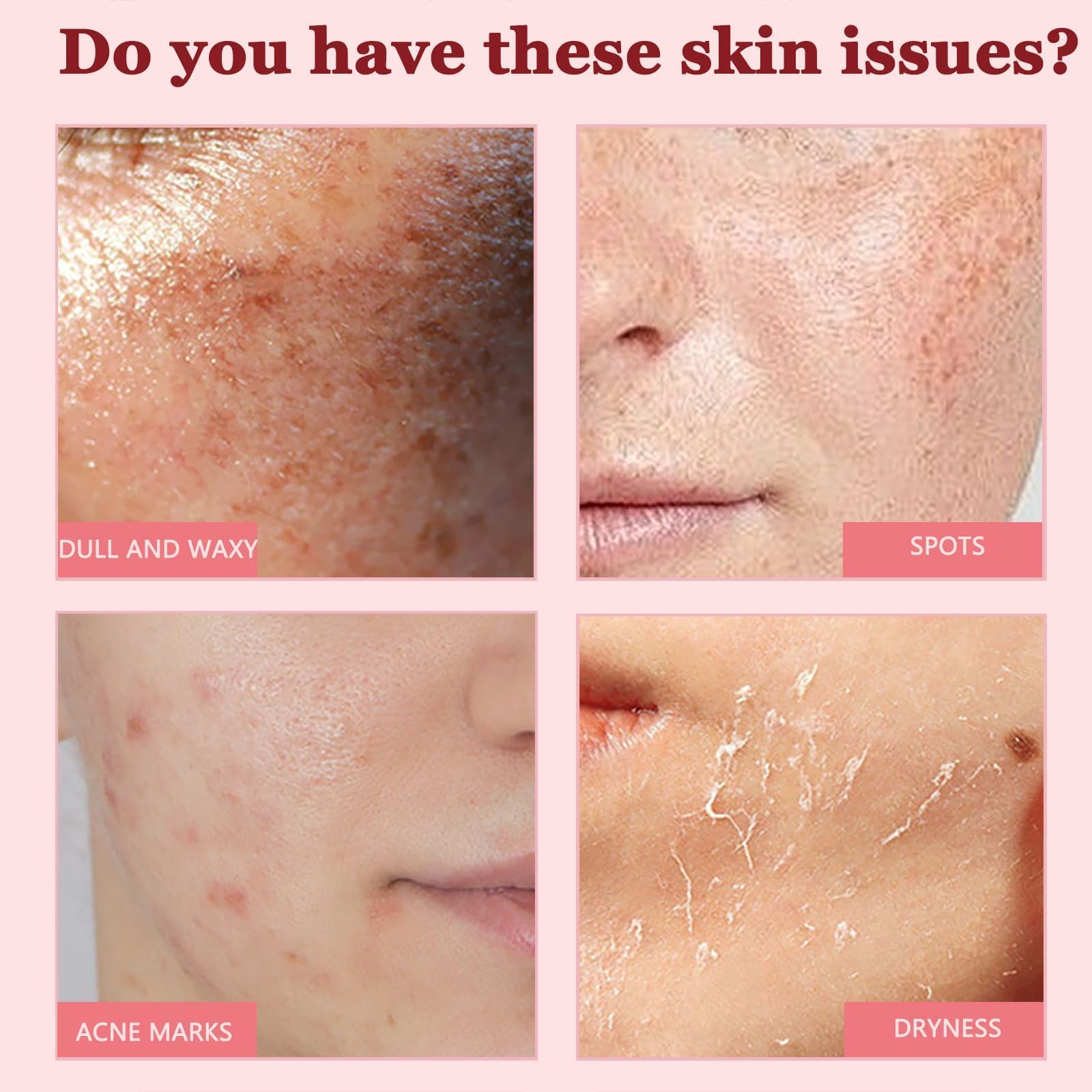 Dark Spot Corrector Serum - Improves Tone, Enhances Radiance, 30ml Size for Even Tone & Radiant Appearance - Image 2