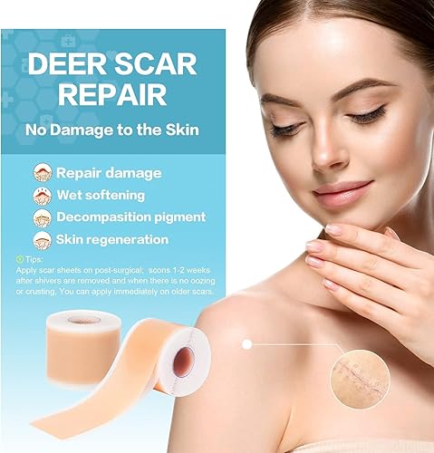 Miniatura 5 de Hojas de silicona para cicatrices (rollo de 1.6 x 120 pulgadas, 1 rollo de 9.8 ft), 1 rollo de cinta de silicona lavable de grado médico, hojas