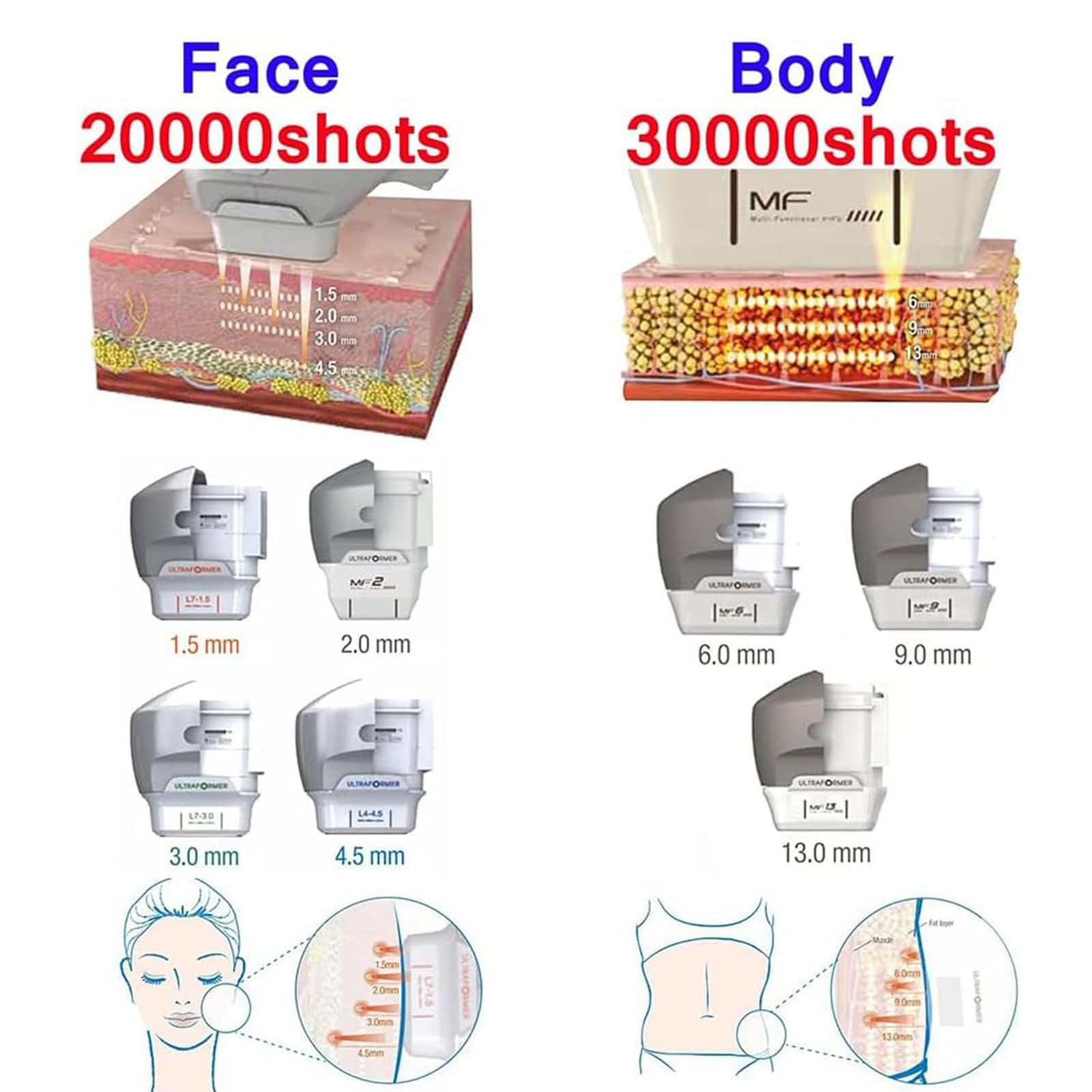 Máquina Adelgazamiento Corporal 7d Hifu con 7 Cartuchos para Reafirmar La Piel, Eliminar Grasa Corporal, Lifting Facial Profesional, Reafirmar La Piel, Aliviar El Dolor Y Adelgazar
