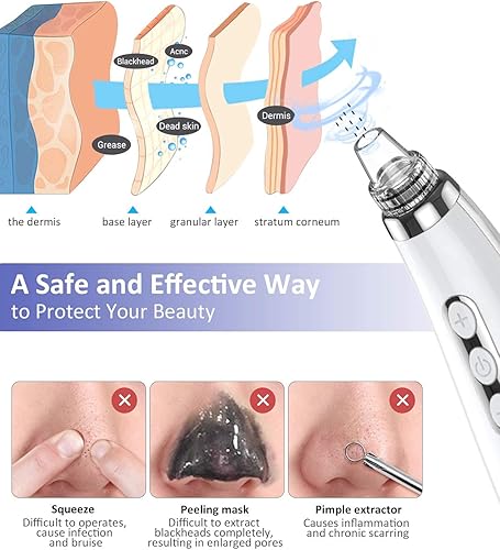 Miniatura 2 de Aspirador de poros de puntos negros, limpiador facial mejorado 2023, limpiador eléctrico recargable por USB, extractor de puntos blancos con 5