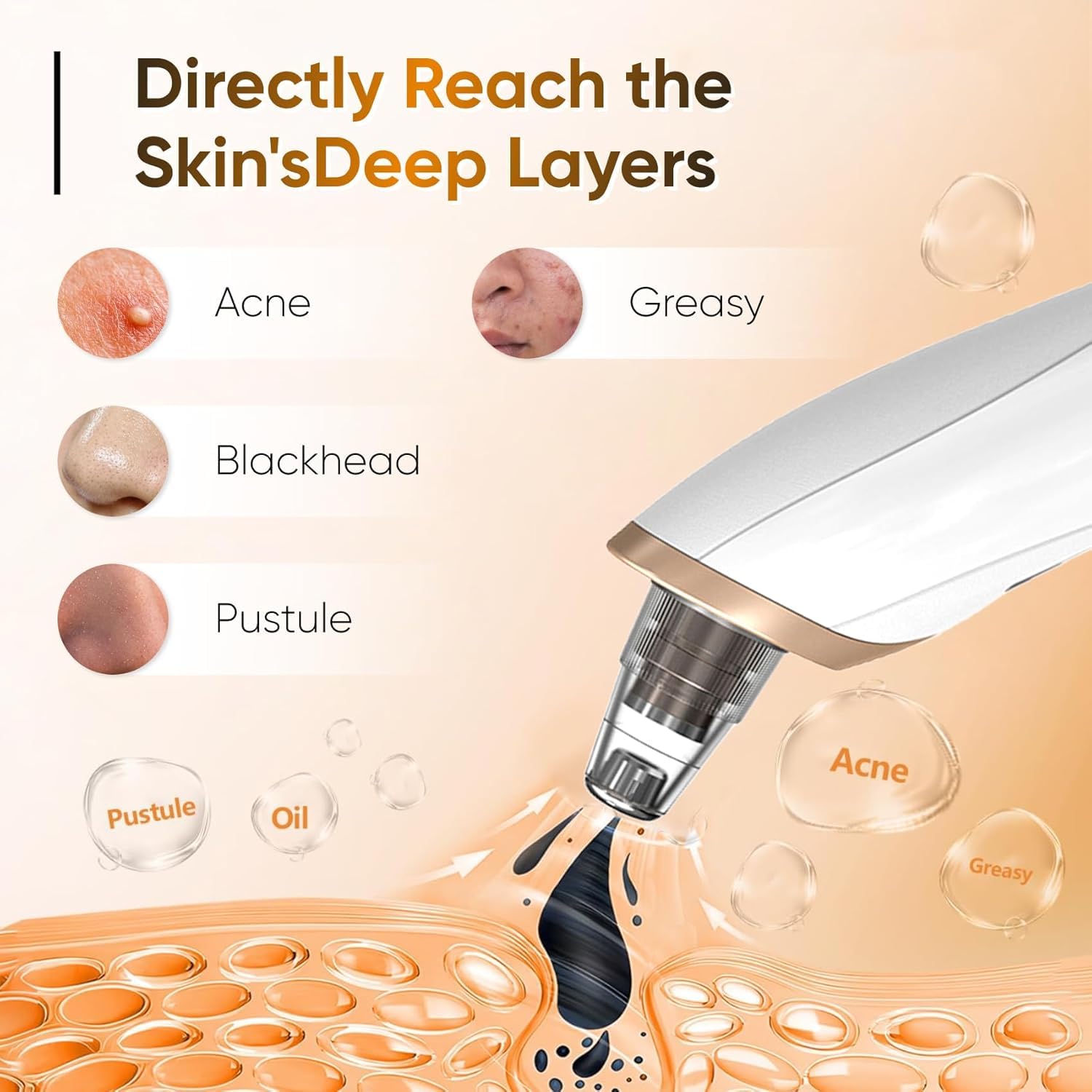 Feelon 5-in-1 Blackhead Remover Machine – Electric Pore Cleaner & Whitehead Removal Tool, Deep Face Cleaner Machine for Acne, Pimple & Blackhead Removal, USB Rechargeable Derma Suction Device
