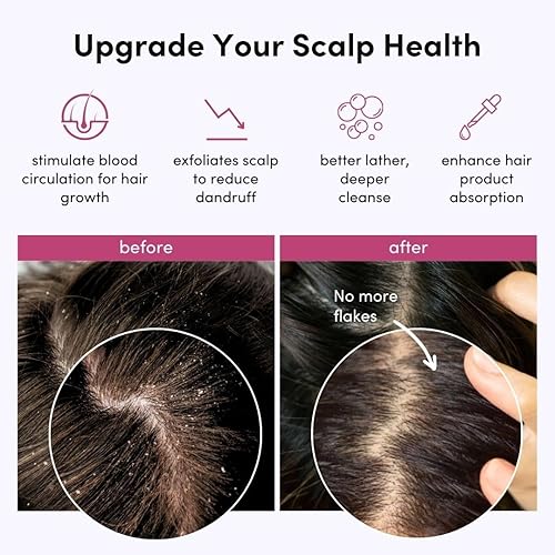 Miniatura 5 de Fancii Masajeador de cuero cabelludo para cabello húmedo y seco, cepillo de champú para cabello húmedo y seco, exfoliante para eliminar la caspa y