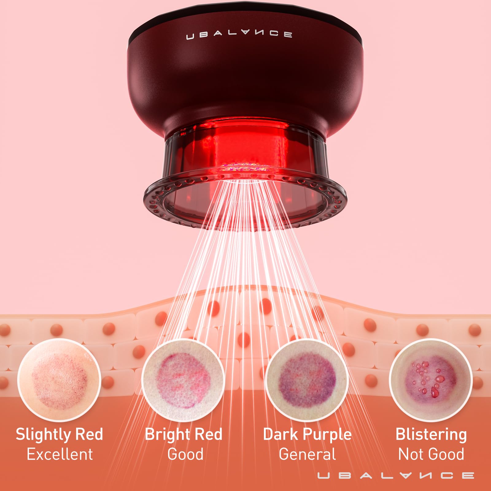 Cupping Therapy Set, Smart Electric Cupping Massager, 4