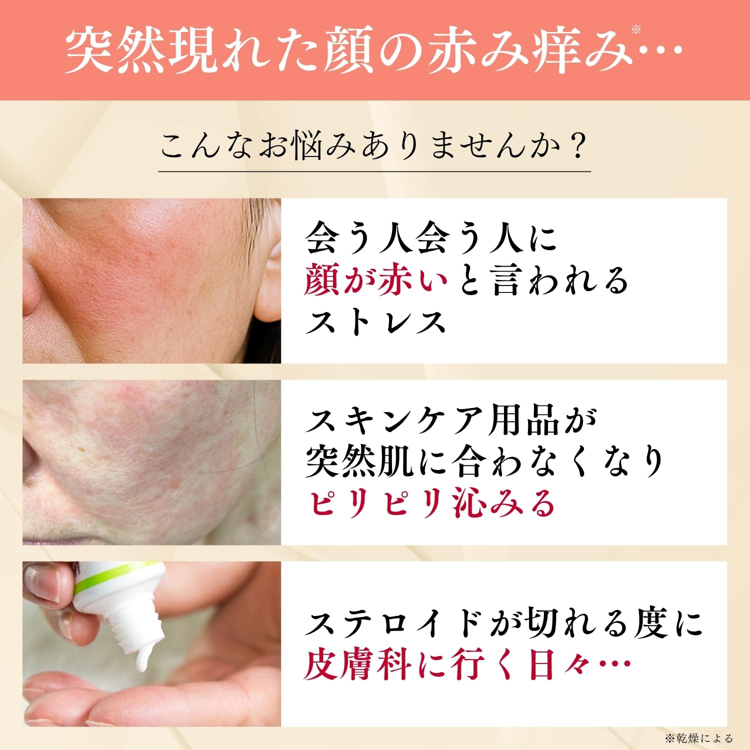 Amazon | 突然の赤み痒みに クレチュール ジュレローションEX ナノミド