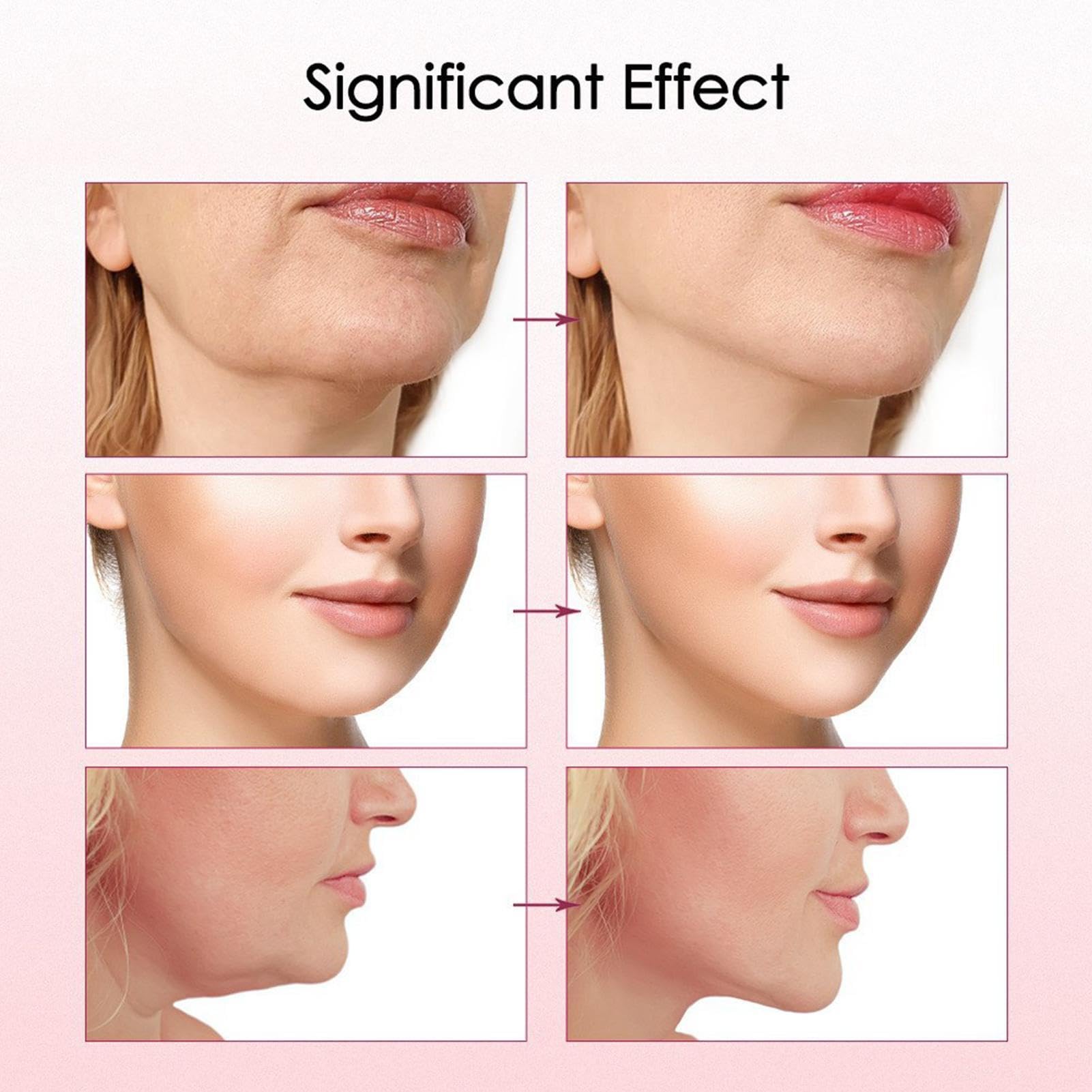 V Face Lifting Gerät - 8 Modi Elektrisches Gesichtsmassagegerät mit 15 Stufen