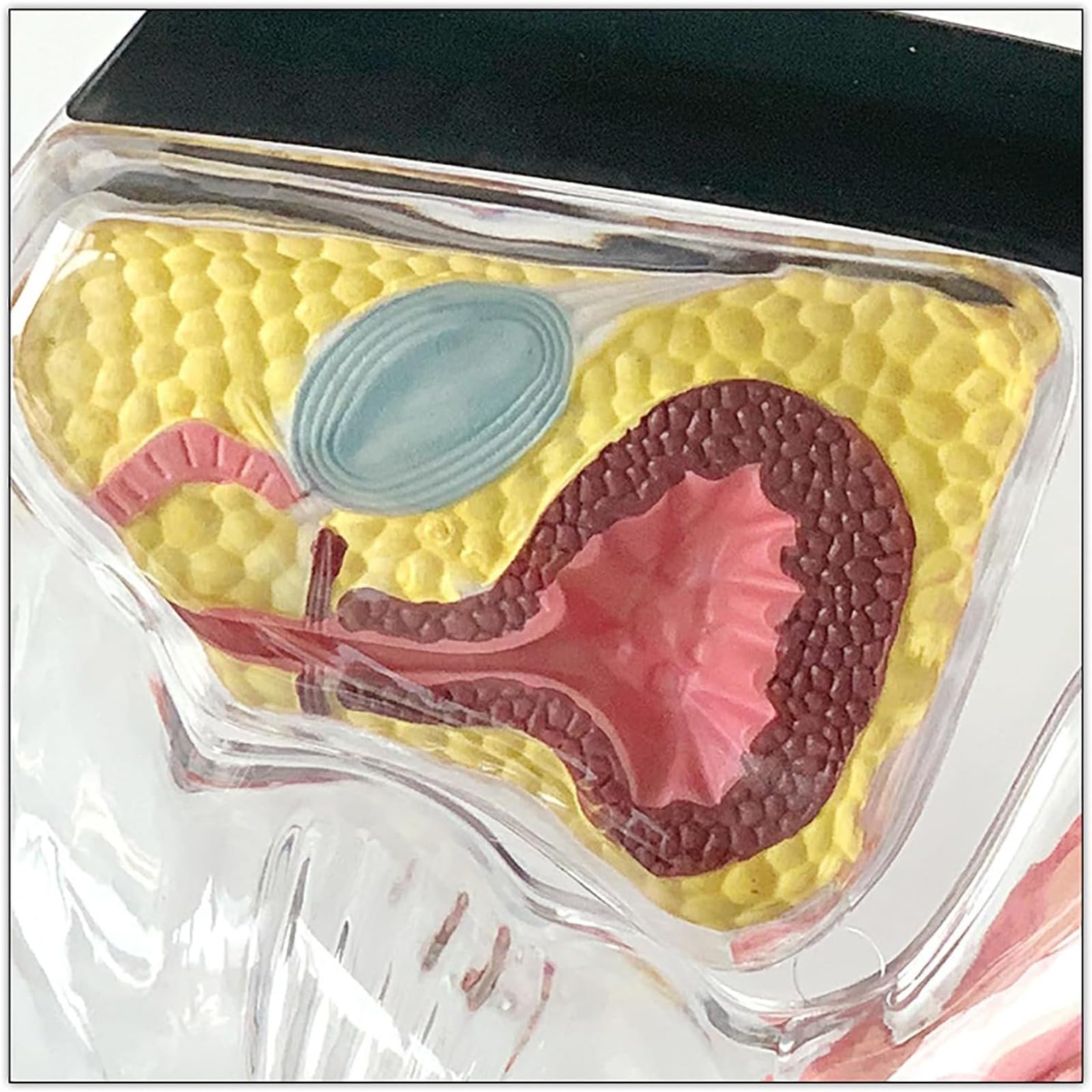 Transparentes Gebärmuttermodell, Lehrmodell zur Demonstration der Menstruationstasse als Verhütungsmittel, Blasen-Becken-Modell, leuchtende Farben, mit Sockel, für die Ausbildung