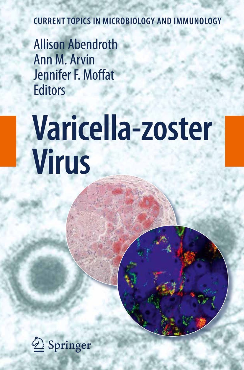 Buy Varicella-zoster Virus: 342 (Current Topics in Microbiology and Immunology) — BookShops.in