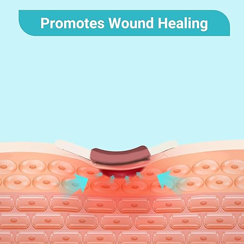 Miniatura 5 de Conkote Almohadillas de alginato plateado para heridas de 4 x 4 pulgadas, paquete de 5 parches antiadherentes, altamente absorbentes para úlceras