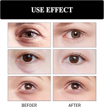 Periocular Skin Care Instant Firm Eye, Binozity Skin Tightener, Temporary Face Tightener, Instant Face Lift Cream, Sebum Remover, Oily Skin Moisturizer, Pore Filler (1pcs)