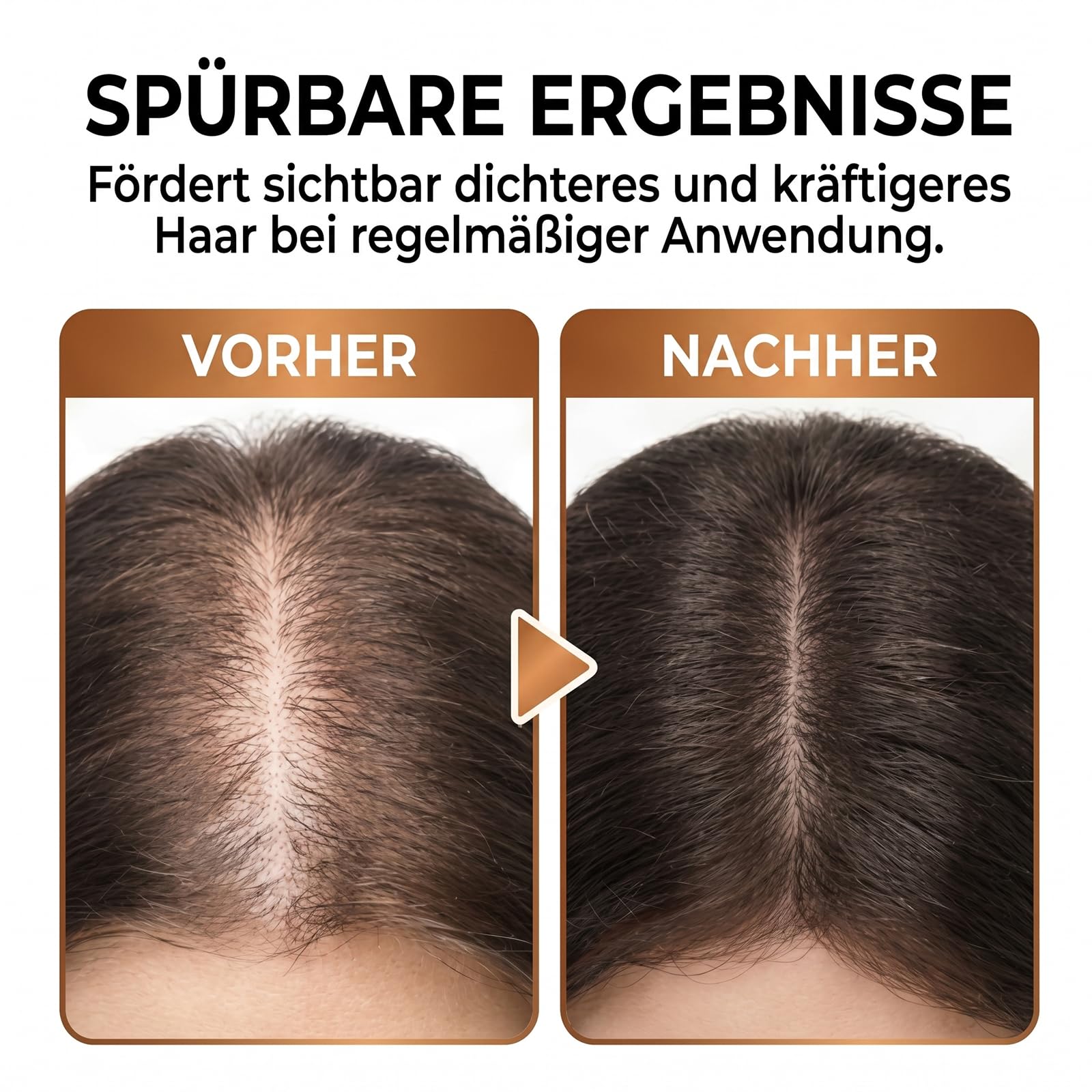 Haarwachstum Spray, Hair Growth Spray, Haarwachstum Beschleunigen, Serum Aktivierung Kopfhauterneuerungskomplex für Frauen und Männer Tägliche Haarpflege, 60 ml