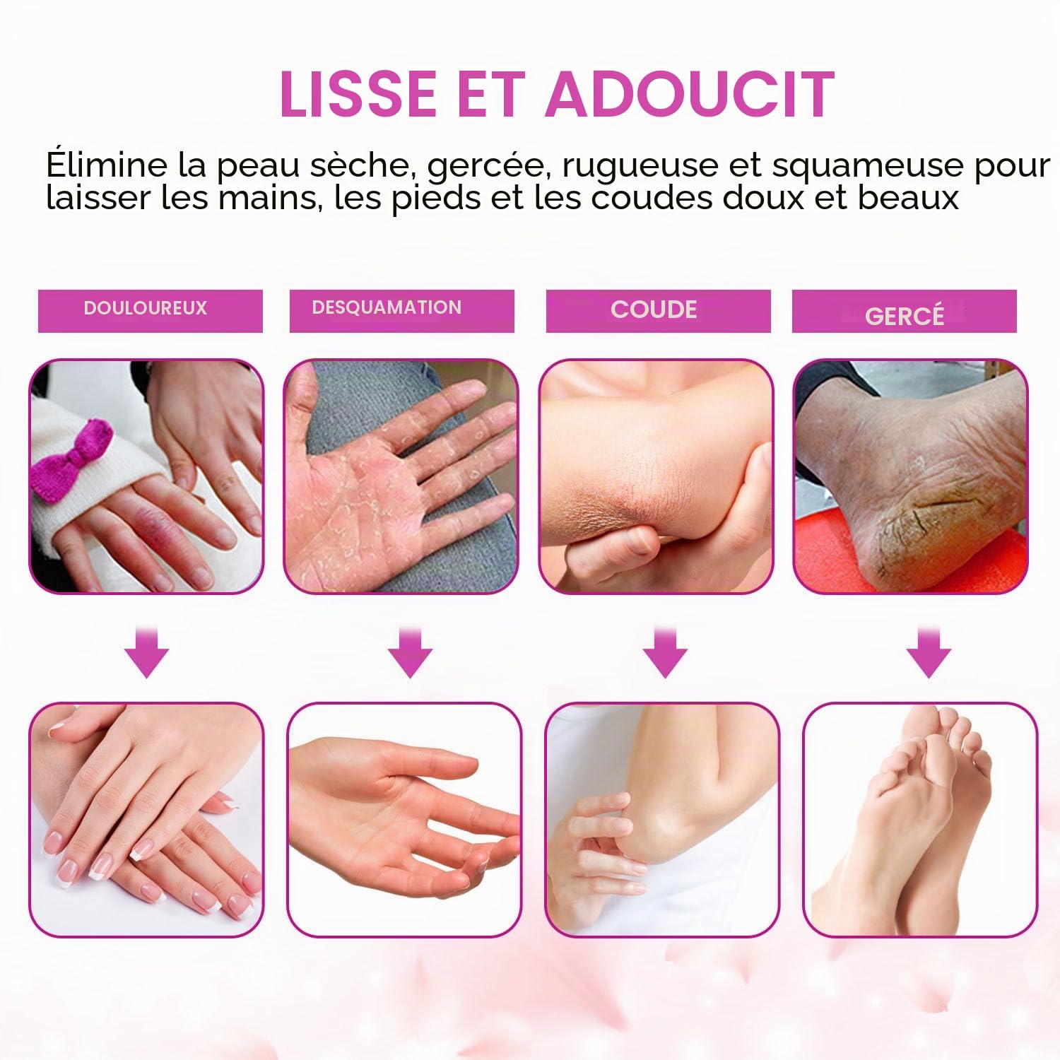 Bain de Cire Forever Speed 265W Bains de Paraffine pour Mains et Pieds Électrique Rose