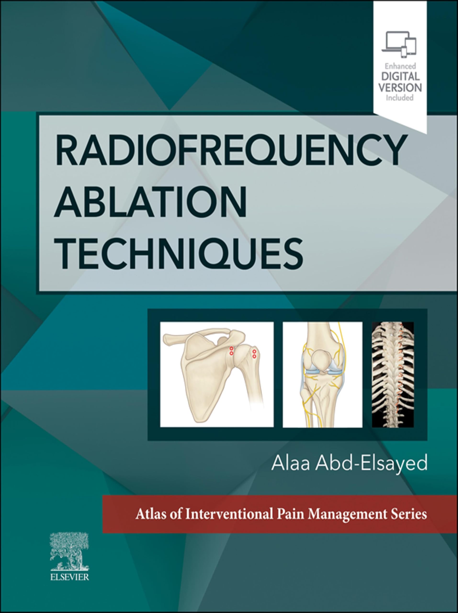Radiofrequency Ablation Techniques - E-Book: A Volume in the Atlas of Interventional Techniques Series (English Edition)