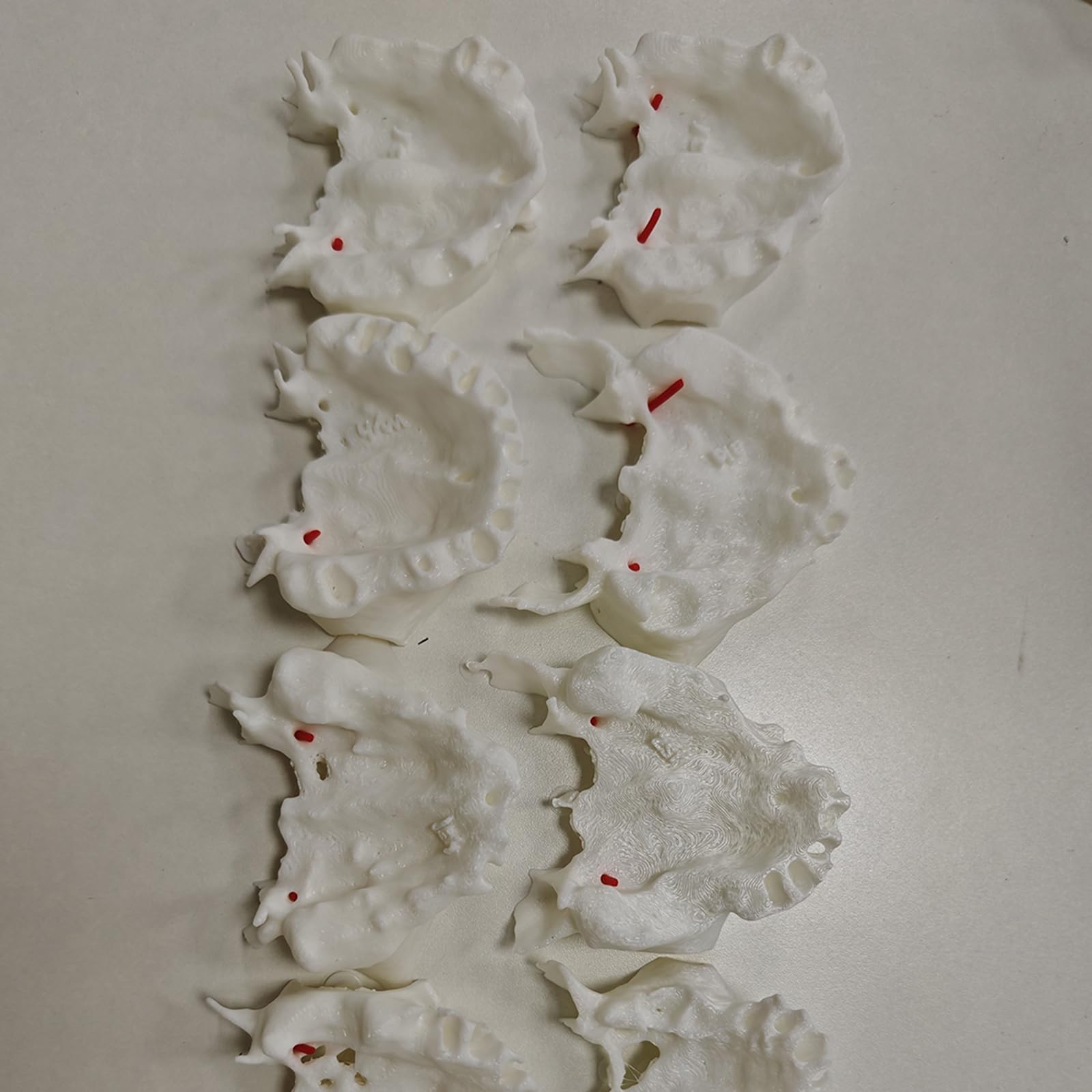 10 Pezzi Modello Dentale dei Denti Include Esercizi di Impianto dell'Arteria Palatina Basati su CT Modello Dimostrativo per Impianto Denti Trasparenti per Studio e Insegnamento