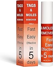 Wart Remover Ointment, Skin Tags & Moles Remover, Wart removal cream for face Wart Removal | Massa Remover Ointment For Skin | Skin Tag Remover Cream – Fast, Easy & Effective Formula for All Skin Type (PACK OF 1)