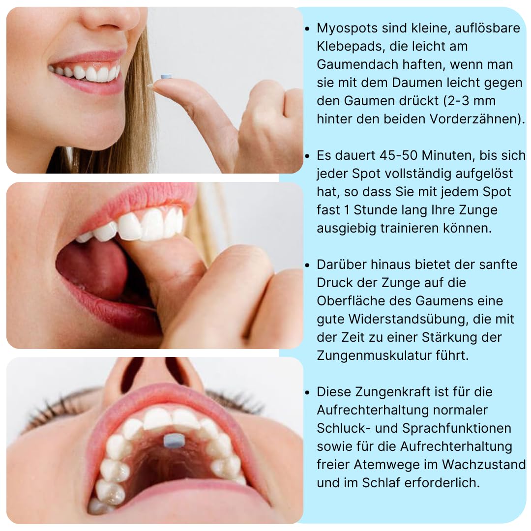 Myospots - Entraînement efficace pour la repos de la langue dans différents goûts - 100 comprimés - Soutien polyvalent pour la respiration et la santé (banane)