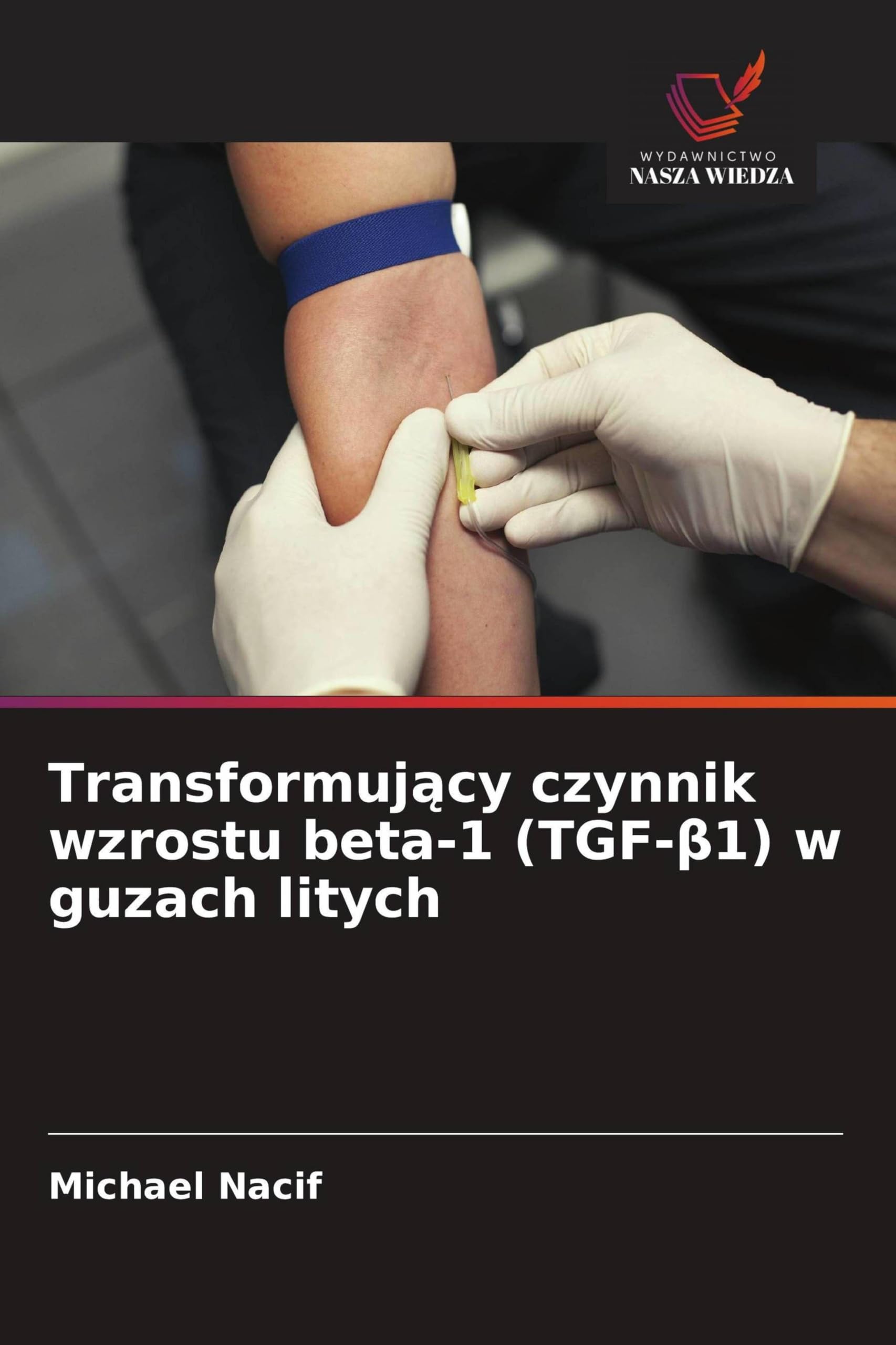 Transformujący czynnik wzrostu beta-1 (TGF-β1) w guzach litych