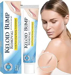 Remoção De Queloides, Creme Silicone Para Cicatrizes Cirurgias E Queimaduras, Tratamento Queloides Piercings Orelha