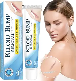 Remoção De Queloides, Creme Silicone Para Cicatrizes Cirurgias E Queimaduras, Tratamento Queloides Piercings Orelha
