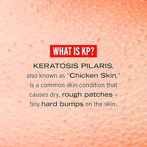 Miniatura 3 de First Aid Beauty KP Bump Eraser Body Scrub Exfoliante para queratosis pilaris con 10% AHA  8 onzas + tubo de tamaño de viaje de 1 oz