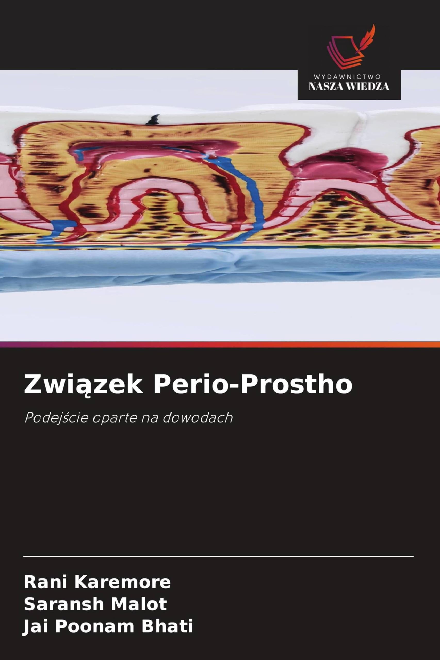 Zwi¿zek Perio-Prostho: Podej¿cie oparte na dowodach