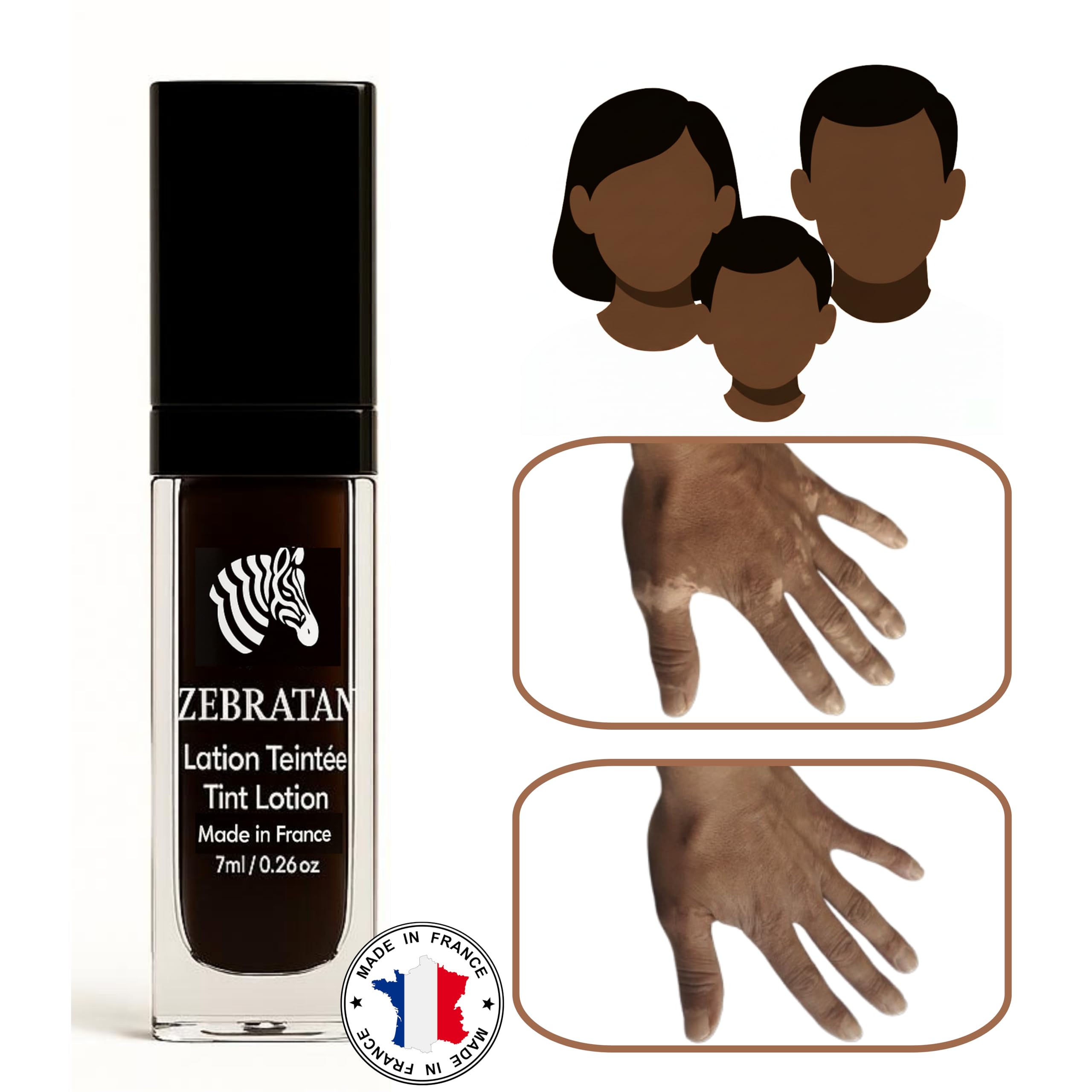 Lotion do makijażu bielactwa 7 ml – Maskuje białe plamy na skórze – Naturalny kamuflaż bez tłuszczu, nie podkład – Mężczyźni, Kobiety i Dzieci – Samoopalający, Wegański – Głęboki brązowy odcień
