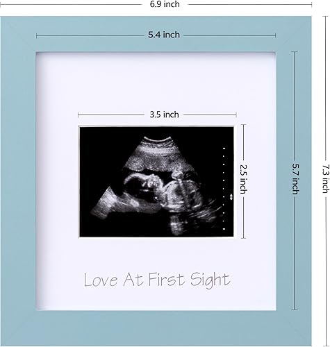 Miniatura 3 de eletecpro Sonogram - Portarretratos con ultrasonido de 3 x 4, marcos de fotos de ultrasonido para anuncio de embarazo, regalos únicos para mujeres