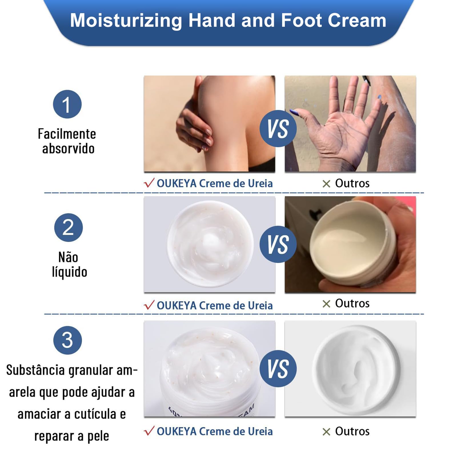 Crema Piedi Urea 40%,150g,Crema Piedi Secchi Screpolati,Cream Foot Urea,Trattamento Per Talloni Screpolati,Ammorbidimento Dei Calli E Cura,Per Foot,Mani,Talloni,Gomiti,Unghie E Ginocchia