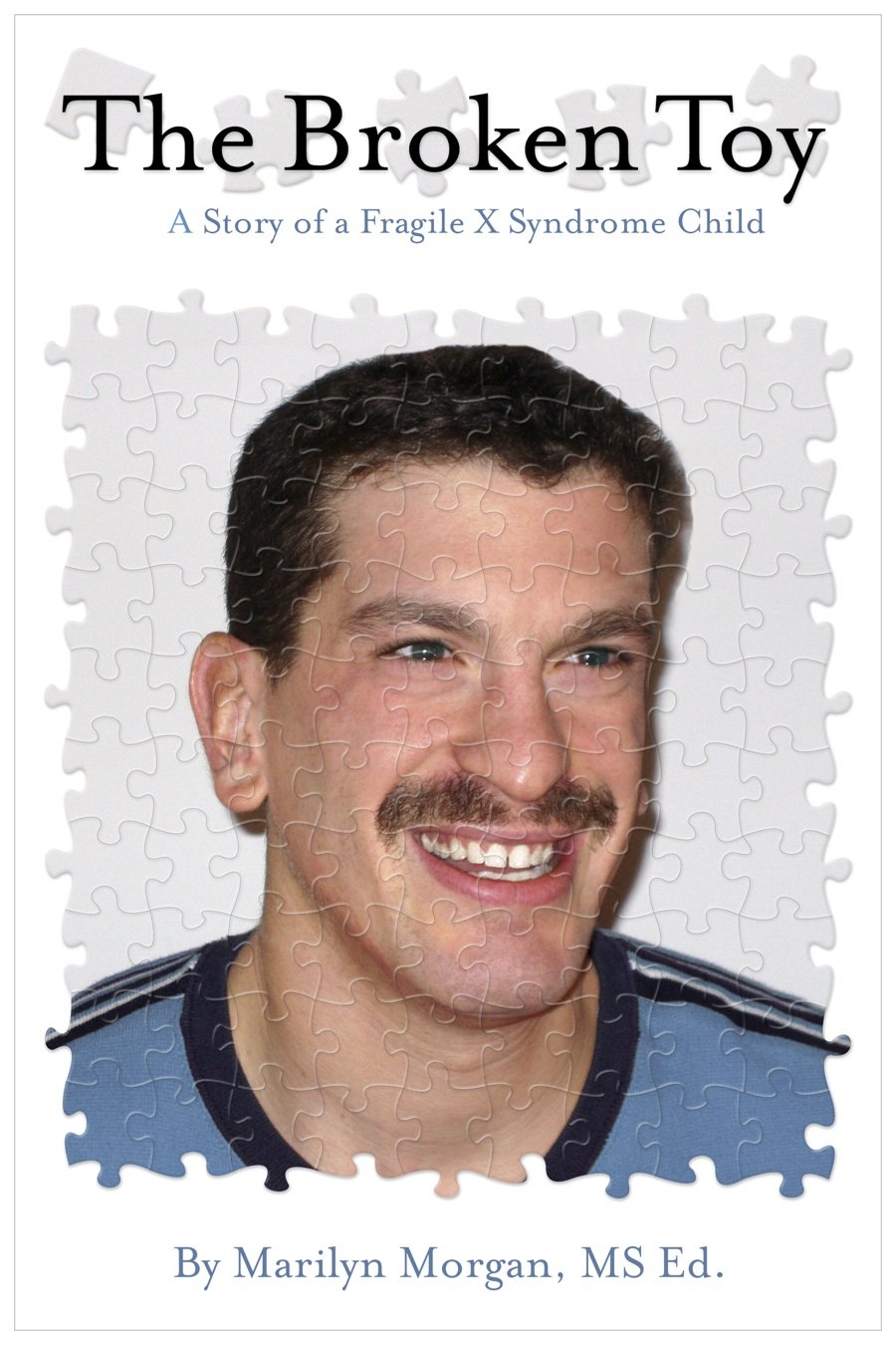 The Broken Toy A Story of a Fragile X Syndrome Child eBook