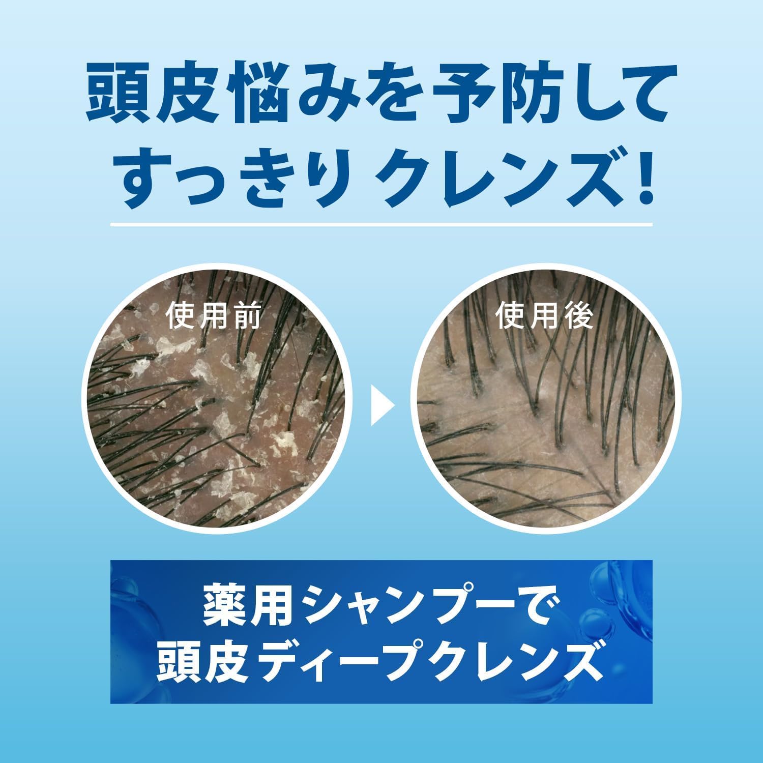 Amazon | h&s エイチアンドエス モイスチャー シャンプー 詰め替え 大
