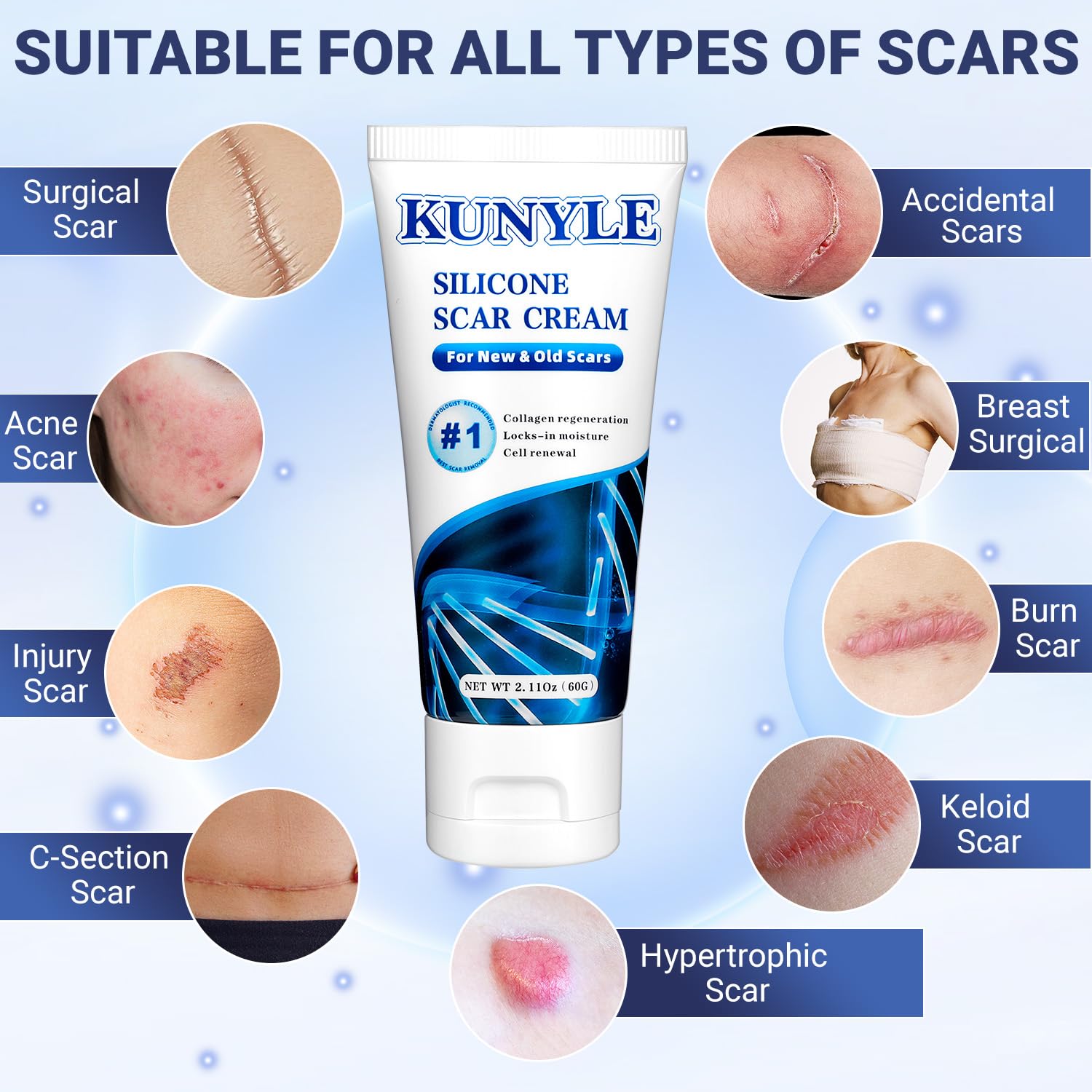 Scar Cream, Silicone Scar Gel, Advanced Scar Removal Cream for Surgical Scars, Stretch Marks Removal, Keloid Bump Removal, Old and New Scars 2.11 Oz (60g)