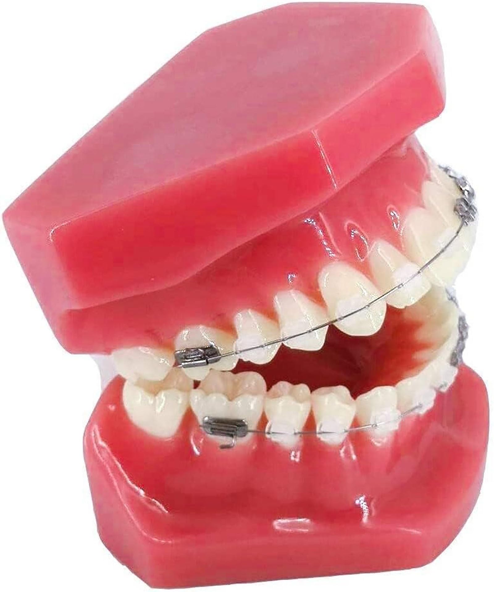 Zahnärztliches kieferorthopädisches Modell, Zahnmodell mit Metall- und Keramikklammern, orale Demonstrationsmodelle for den zahnärztlichen Unterricht oder die Kommunikation mit dem Zahnarzt.
