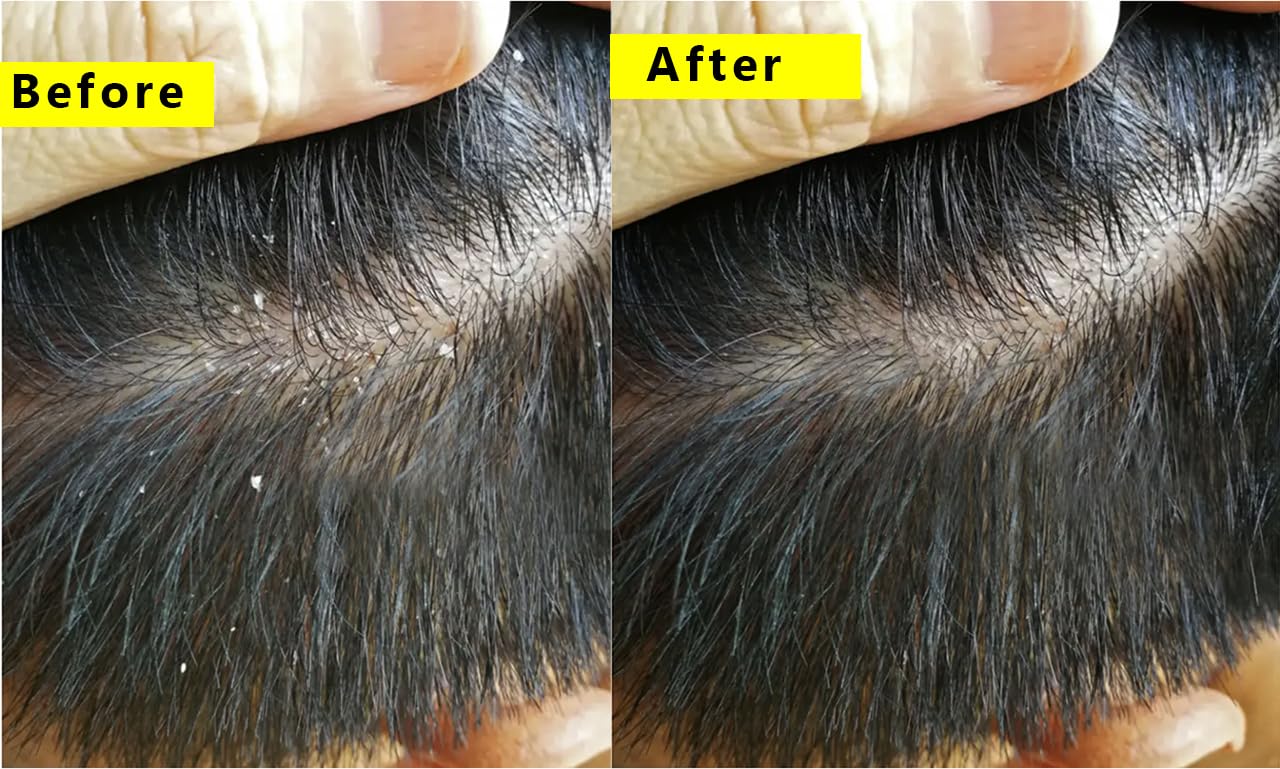 Haarspray mit Reiswasser und Rosmarin, 100 % handgefertigt, feuchtigkeitsspendend, Rosmarinöl & Rosmarin-Shampoo gegen Haarausfall für alle Haare