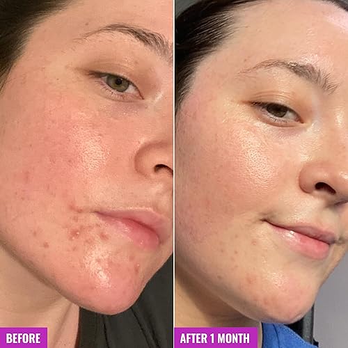 Miniatura 5 de Good Molecules Barra Clarify and Cleanse paquete de 3